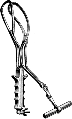 Obstettic Forceps