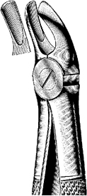 Tooth Extracting Forceps